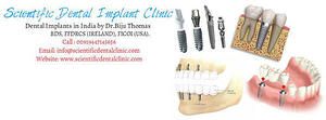 Dental Implant Treatment in New Zealand